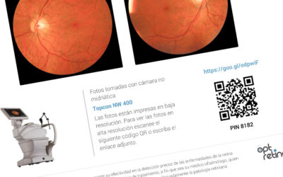 Informe optométrico y de cribado de retina